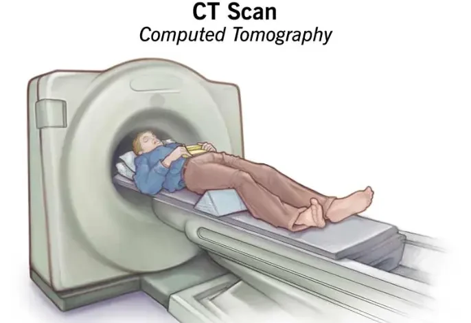What are CT Scans